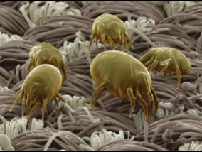 Thats the best night of sleep dust mites in the skin of our couch (Video)