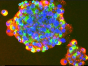 A lab-created cancer stem cells kills